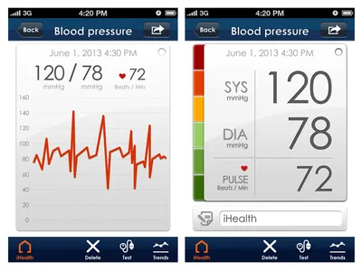 Tensiometru wireless iHEALTH BP5 - braț
