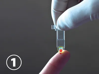 HEMO CONTROL: aparat de măsurat hemoglobină și hematocrit