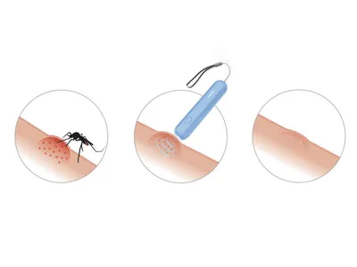 Ajutorul pentru înțepături de insecte