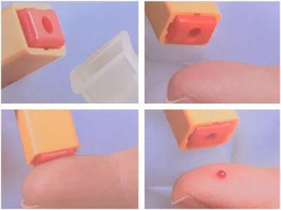 Surgilance safety needle G23 - acupunctoare automate