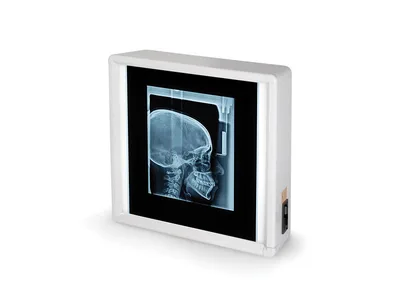 Negatoscop de perete X-ray ral