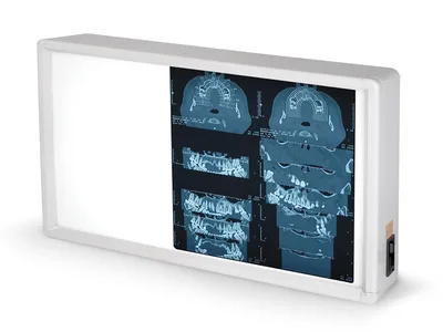 Negatoscop de perete X-ray Dublu