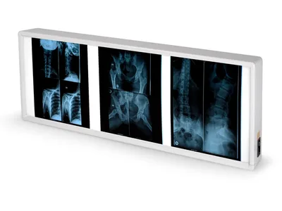 Negatoscop de perete X-ray Dublu XL