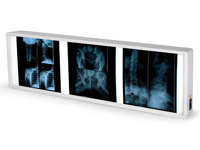 Negatoscop de perete X-ray Triplu
