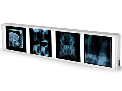 Negatoscop de perete X-ray Cvadruplu