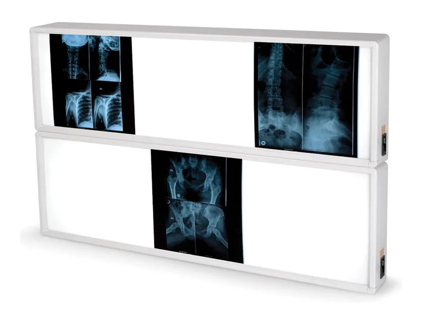Negatoscop de perete X-ray 2x3 filme