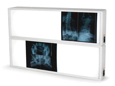 Negatoscop de perete X-ray 2x3 filme
