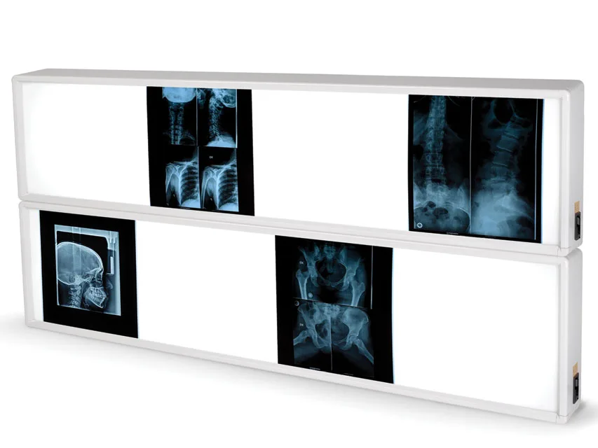 Negatoscop de perete X-ray 2x4 filme