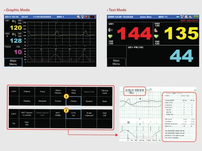 Monitor fetal FC1400 TWINS