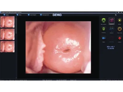 Software de colposcopie pentru 29624, 29625