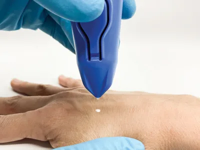 Cryomega aparat criochirurgical cu cartus 16 g
