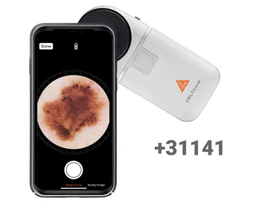 Adaptor smartphone HEINE MAG pentru DeltaOne, Delta 30 - K.000.34.273