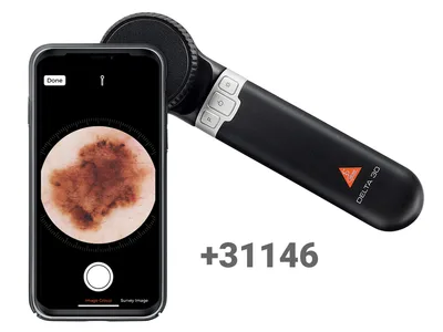 Adaptor smartphone HEINE MAG pentru DeltaOne, Delta 30 - K.000.34.273