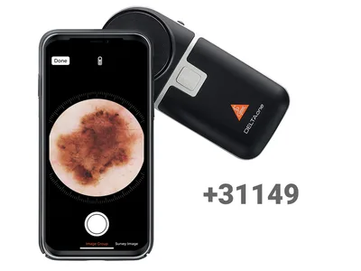 Adaptor smartphone HEINE MAG pentru DeltaOne, Delta 30 - K.000.34.273