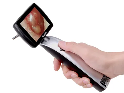 Otoscop video MD SCOPE MS102 - ELITE PACK