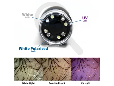 Dermatoscop cu LED polarizat+UV+alb, Wi-Fi și USB, cu software