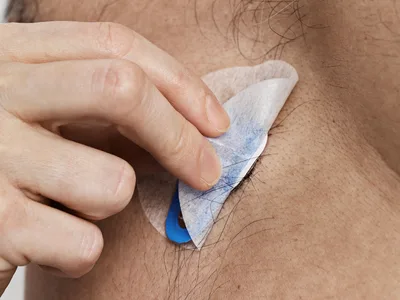 AMBU BLUE SENSOR VL Electrozi ECG - snap