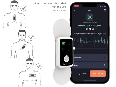 Cardionica 1 canal ECG cu AFib și Bluetooth