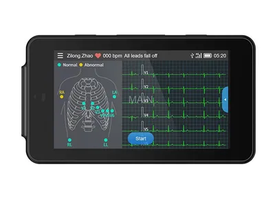 Monitor ECG de buzunar PCECG-500