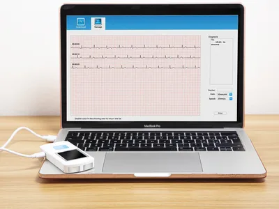 PM10 PALM ECG