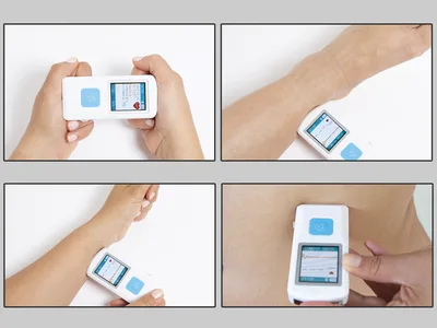 PM10 PALM ECG