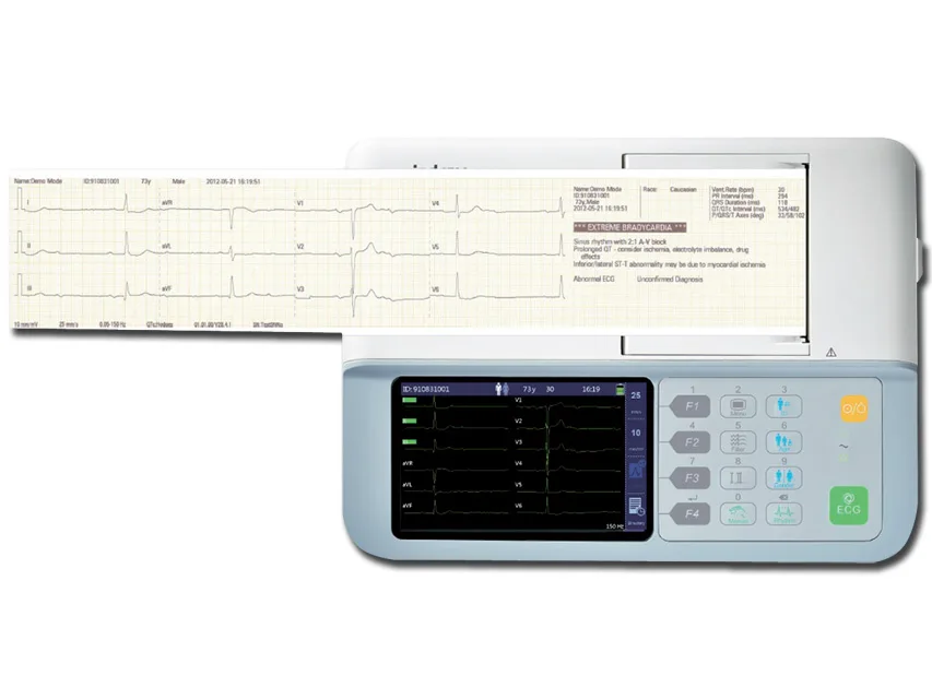 Electrocardiograf portabil Mindray Beneheart R3 - 3 canale