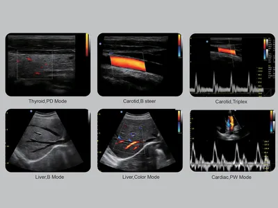 CHISON ECO6 Colour Doppler - conector 2 probe