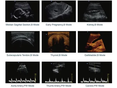 CHISON ECO2 B&W ULTRASOUND - 1 conector sondă