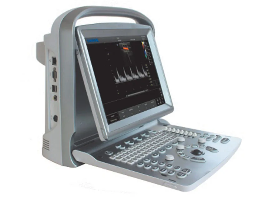 CHISON ECO5 Colour Doppler ultrasound - 2 conectori sonde