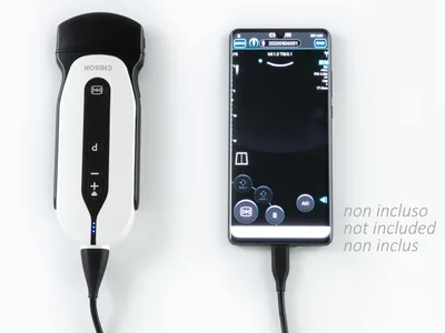 SonoEye P5 Digital Colour Doppler - Sonda convexă