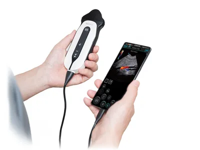 SONOEYE P6 DIGITAL COLOUR DOPPLER - Sondă Micro-Convexă