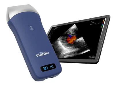 Viatom linear wireless portable ultrasound