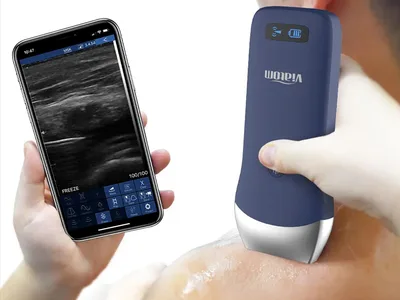 Viatom linear wireless portable ultrasound