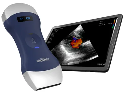 Viatom aparat ecografie portabil wireless cu două capete liniar/convex