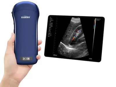 Viatom 3 în 1 liniar/convex/cardiac ecograf wireless portabil