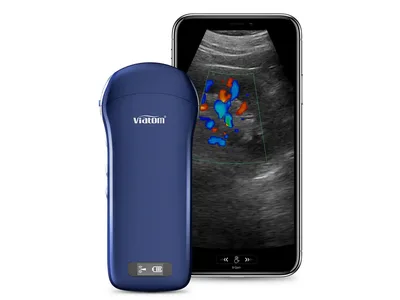 Viatom 3 în 1 liniar/convex/cardiac ecograf wireless portabil