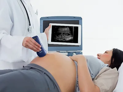 Viatom 3 în 1 liniar/convex/cardiac ecograf wireless portabil