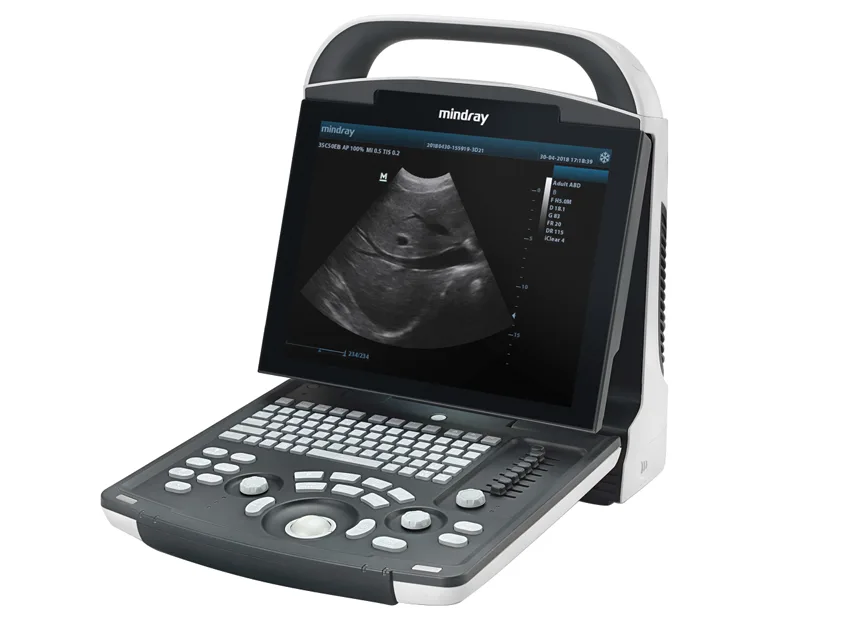 Mindray DP-20 ultrasunografie