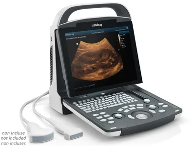 Mindray DP-20 ultrasunografie