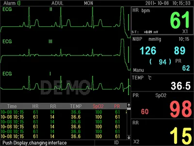 Monitor de pacient multi-parametru PC-3000