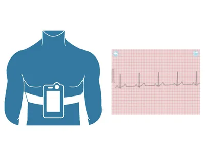CHECKME PRO Monitor vital signs cu ECG Holter - wireless