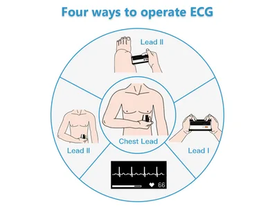 Armfit+ monitor de tensiune arterială cu ECG
