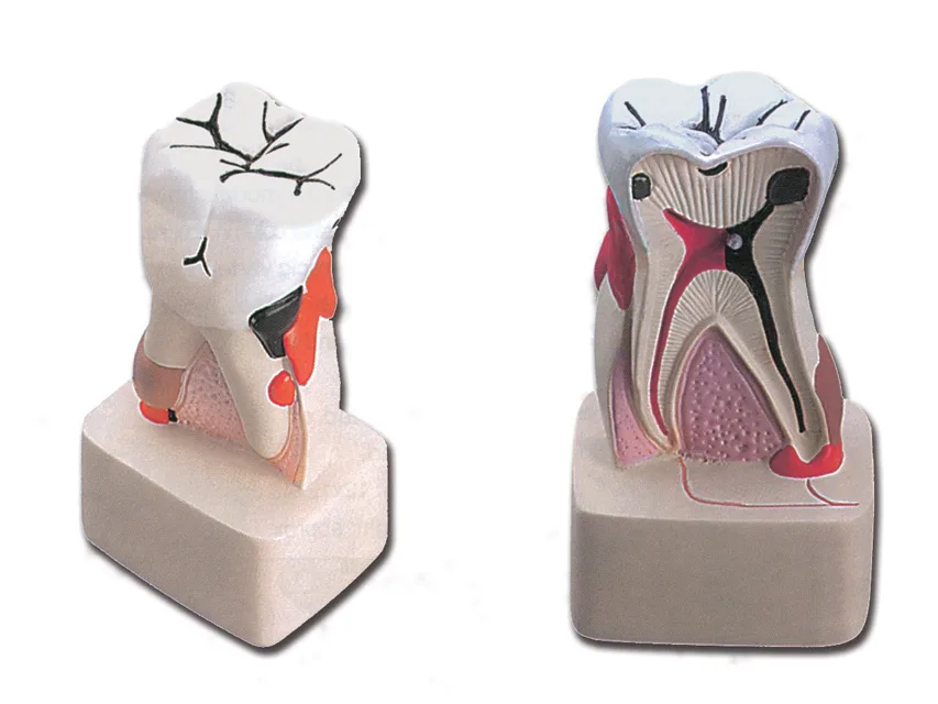 Patologie dentară - 4X