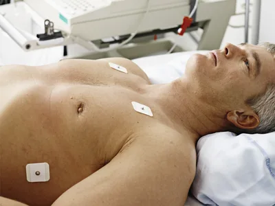 Electrozi ECG Ambu WhiteSensor 4200 - snap
