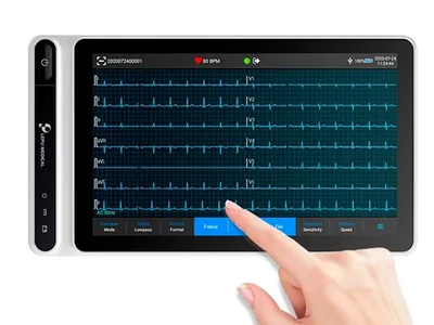 NEO ECG S120 TABLET ECG - SNAP PLUG