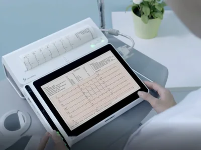 NEO ECG T180 - Tableta ECG cu imprimantă