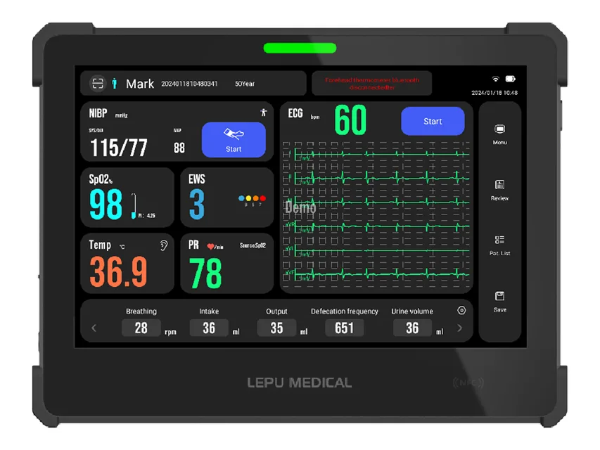Aiview VS tablet vital signs monitor