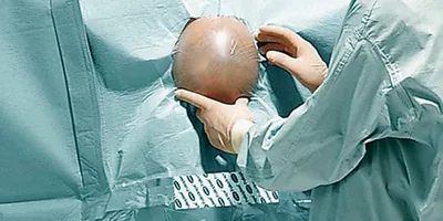 Set Neurochirurgie II