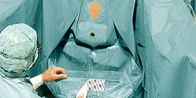 Foliodrape P Urology set VI P4