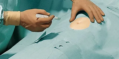 Set Universal/Pediatric I